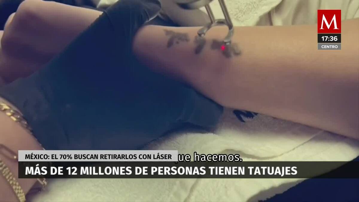Así se ven los tatuajes que se borran con laser