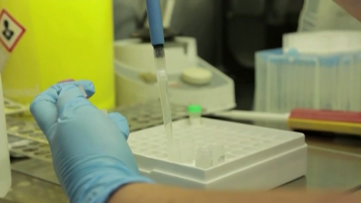 España supera los 4 mil casos de viruela del mono
