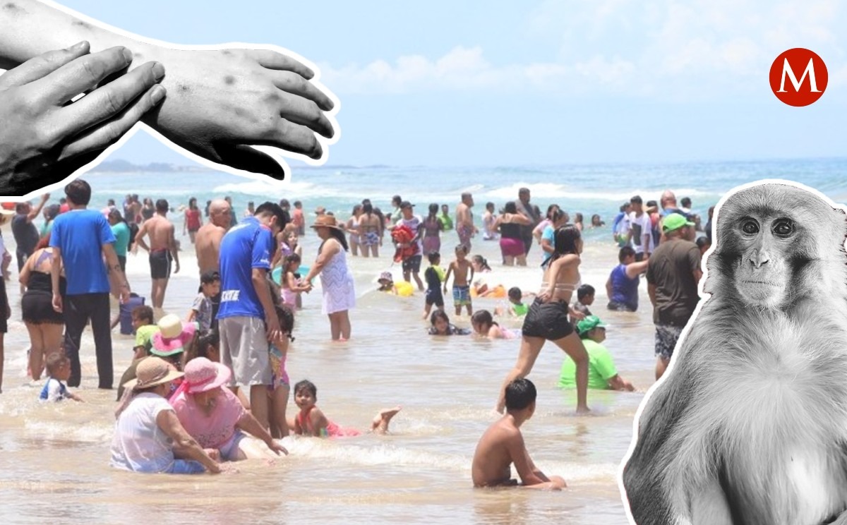 Turista que estuvo en playa Miramar es caso sospechoso de viruela del mono.