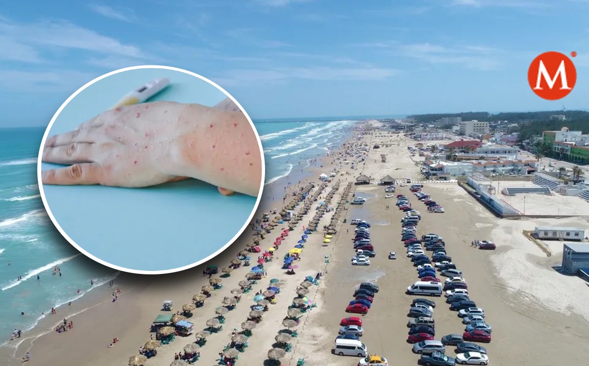 Sin filtros en Playa Miramar ante posible caso de viruela de mono