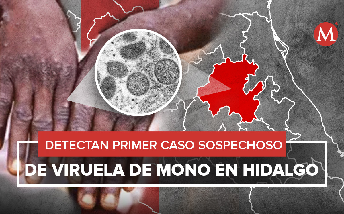 La persona está en aislamiento y supervisión. (Especial)