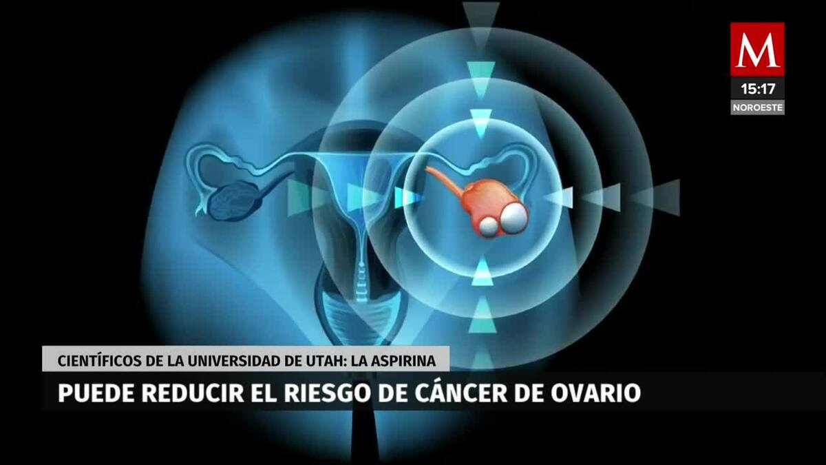 La aspirina podría prevenir riesgo de cáncer de ovario