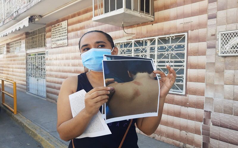 Rubén sufrió violencia por parte de un compañero en su escuela, indicó la madre del menor. | Especial