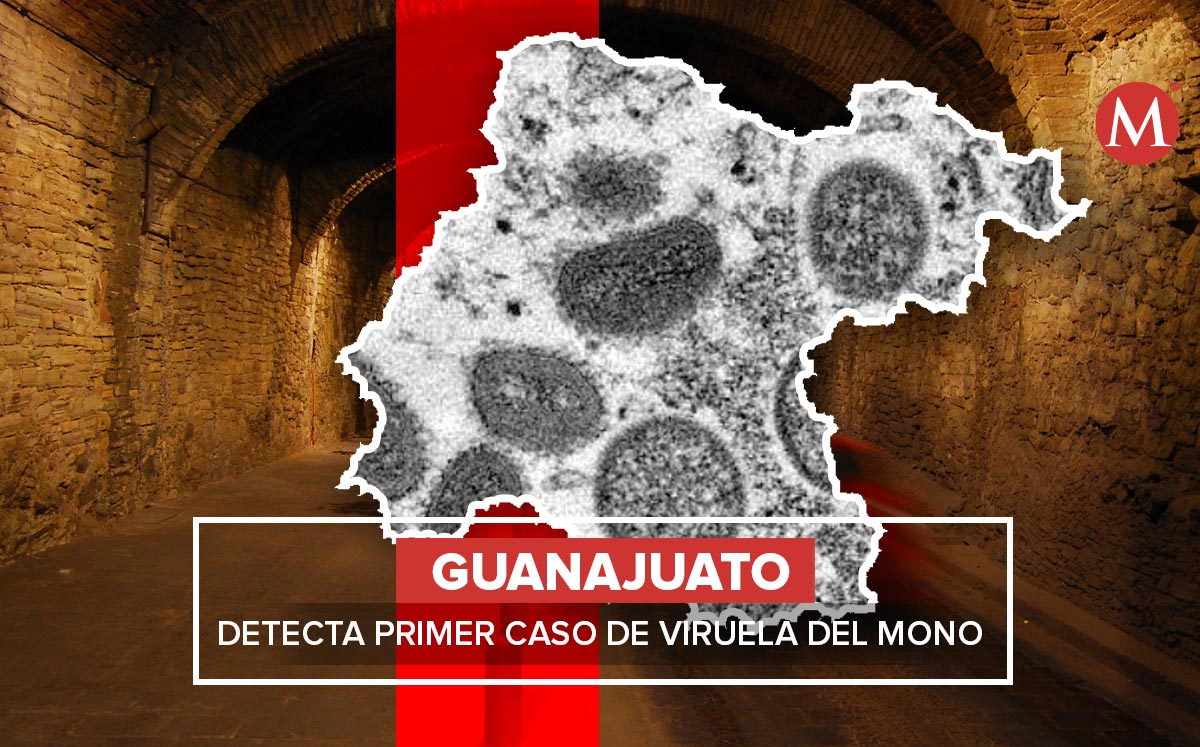 Viruela del mono en Guanajuato: confirman primer caso en la entidad / Especial