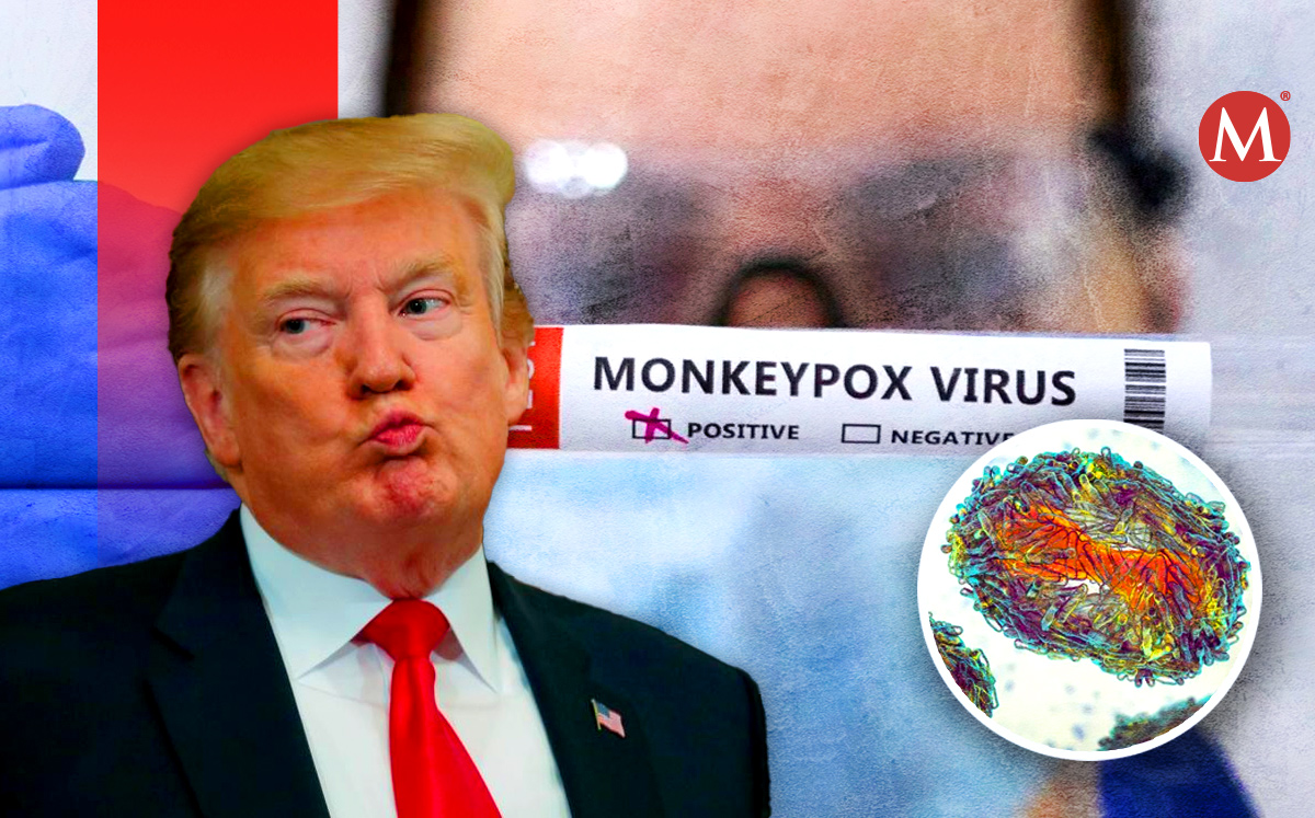 OMS busca renombrar a la viruela del mono (MILENIO).
