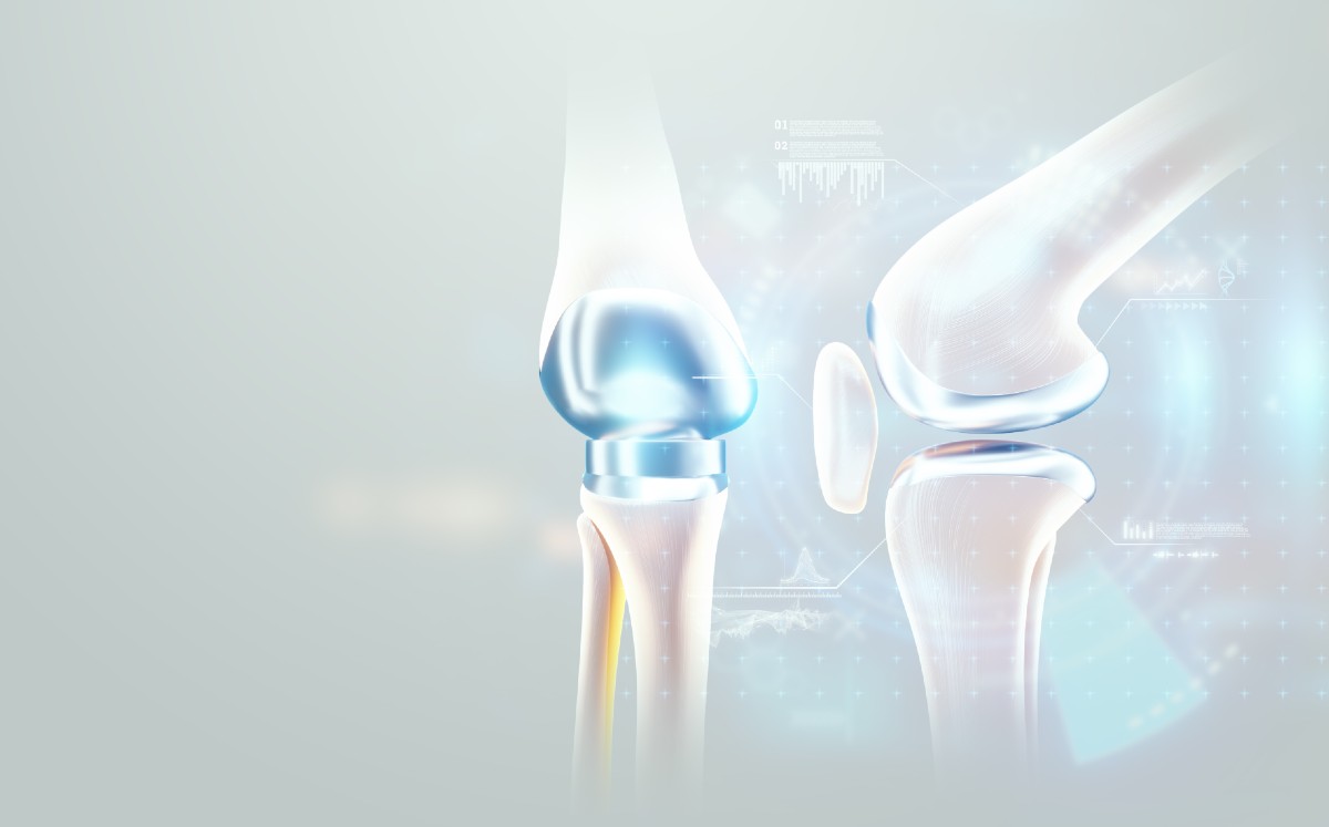 Reemplazo de rodilla asistida por robots (Shutterstock).