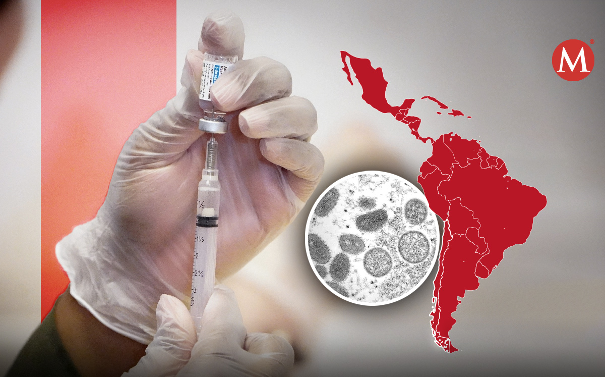 Vacuna contra viruela del mono-. (Especial)
