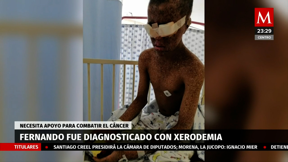 Fernando Núñez tiene cáncer; su sueño, curarse algún día