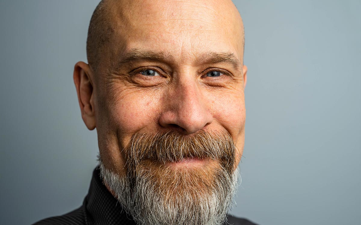 Día Mundial del Calvo