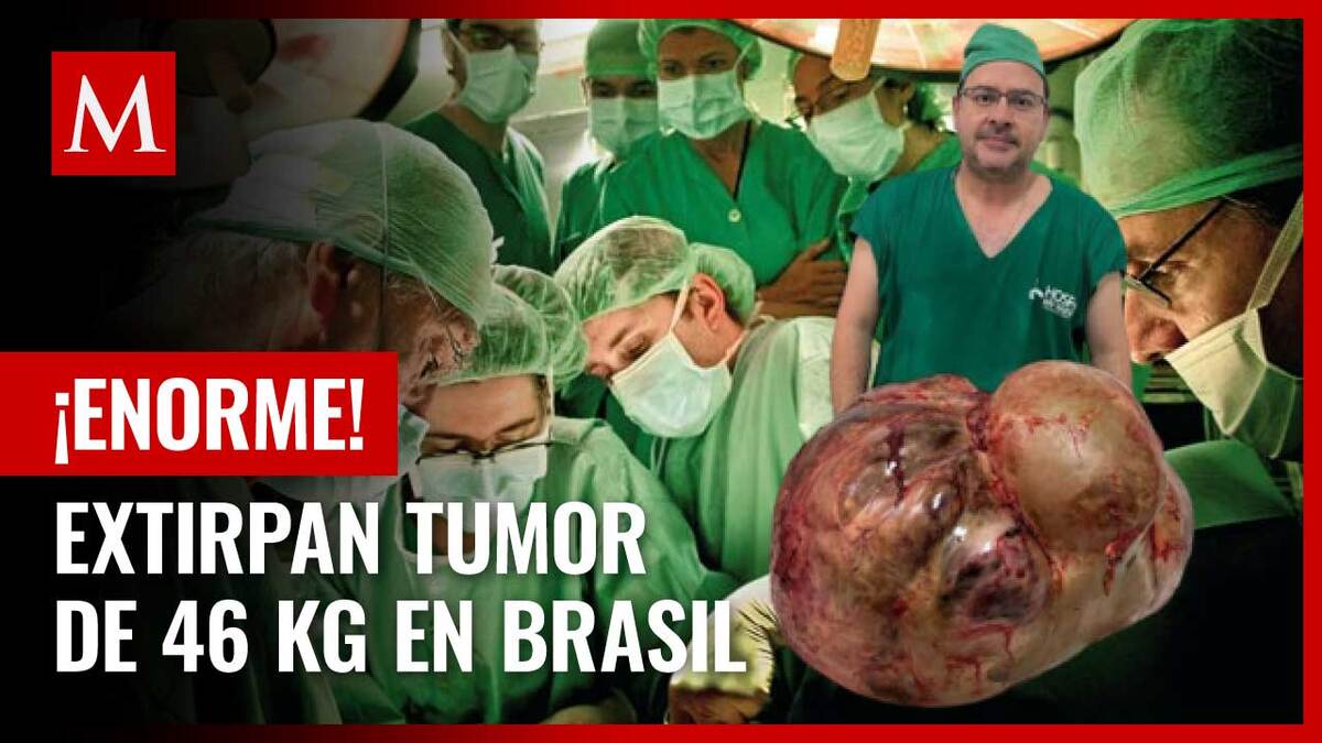 Brasil. Médicos extirpan tumor de 46 kilos a mujer