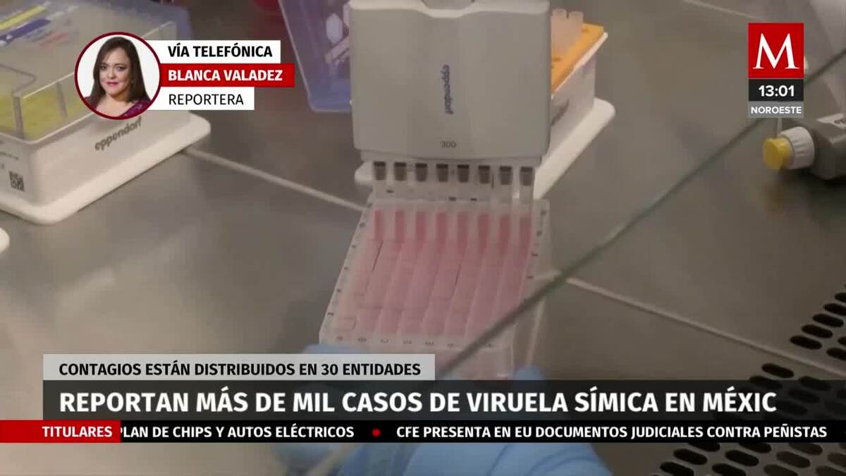 En México auementan a más de mil casos de viruela símica