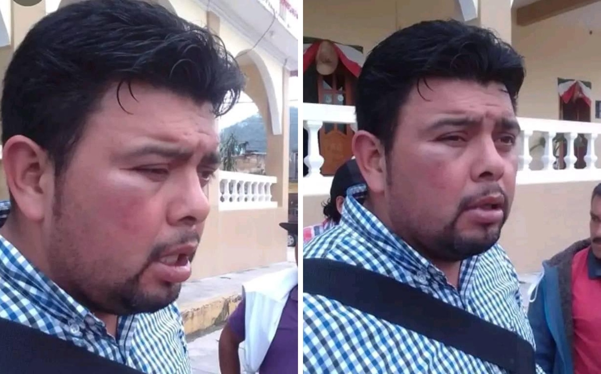 Munguía Vargas terminó con el rostro hinchado y amoratado tras la agresión. | Especial