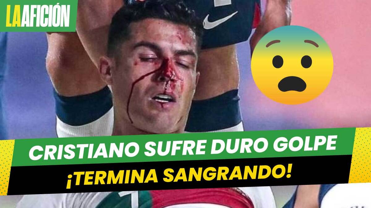 Cristiano Ronaldo recibe fuerte golpe en el rostro con Portugal. VIDEO