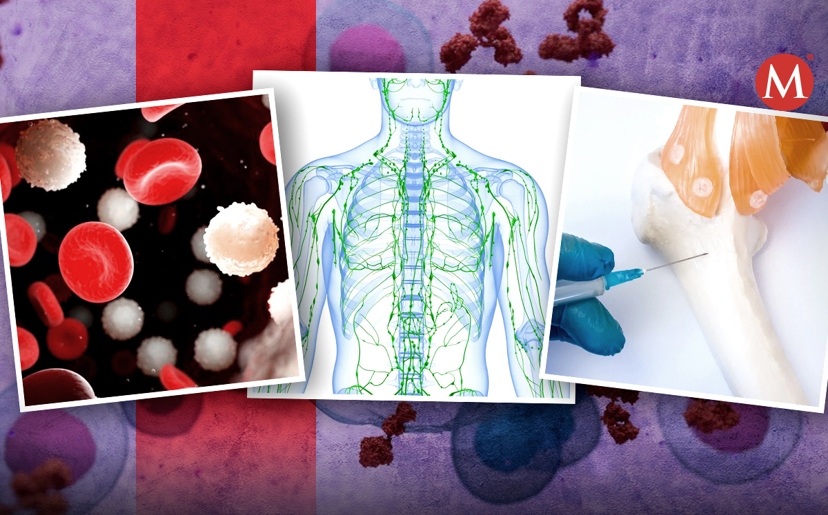 Septiembre es el mes del Cáncer de la Sangre (Especial).