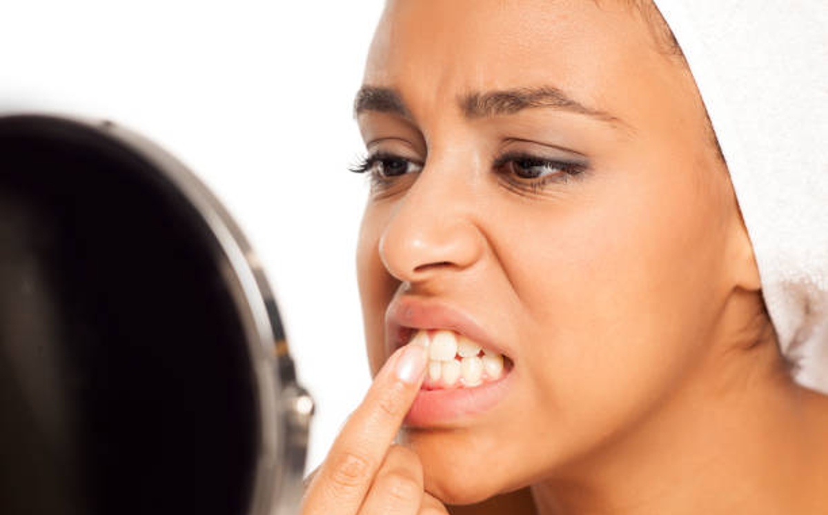 Algunos alimentos contienen pigmentos que se adhieren a los dientes (Pixabay)