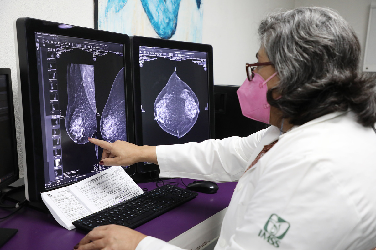 Atención a derechohabientes por Cáncer de Mama en unidades del IMSS