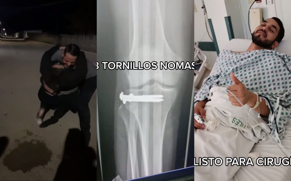 Hombre se fractura la pierna; video se vuelve viral