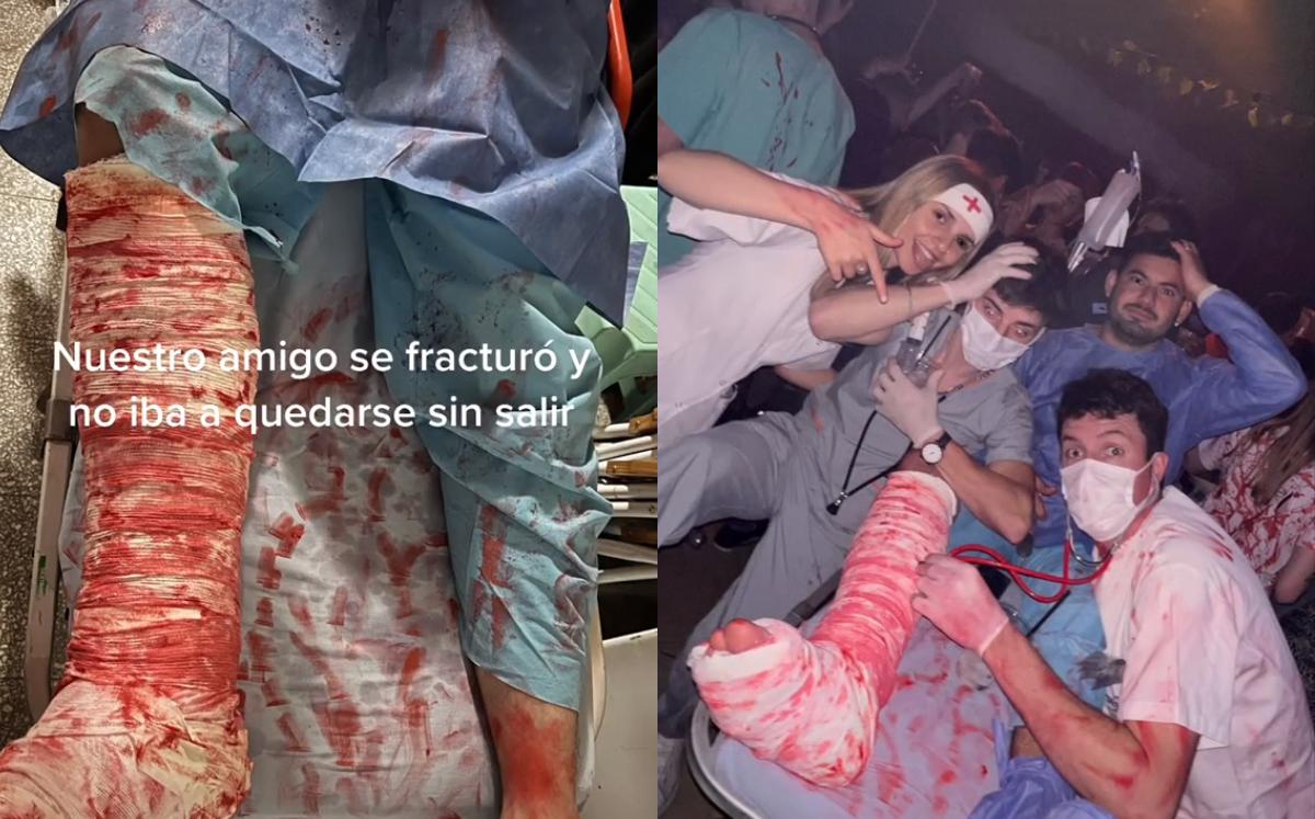 Tener la pierna rota no le impidió asistir a fiesta de disfraces | Especial