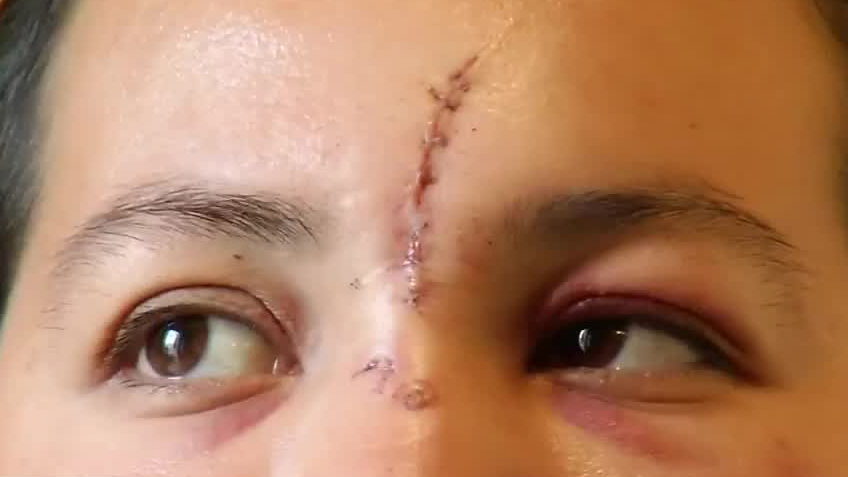 Sobrevivientes narran accidente ferroviario