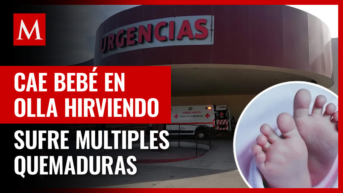 Coahuila: Bebé cae en olla y sufre quemaduras en bautizo