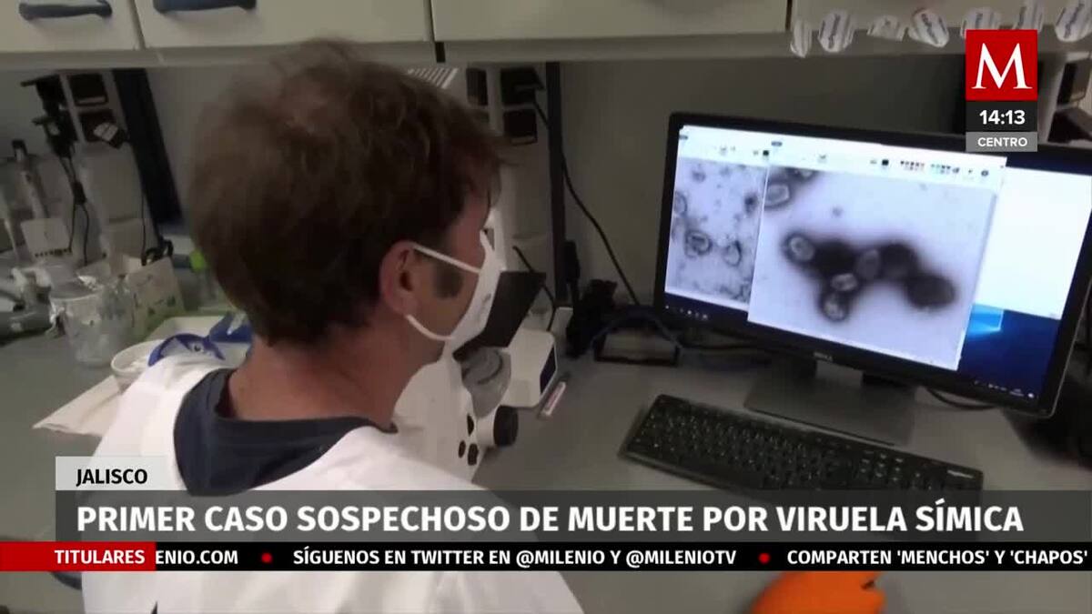Primer caso de muerte por viruela del mono en Jalisco es investigado