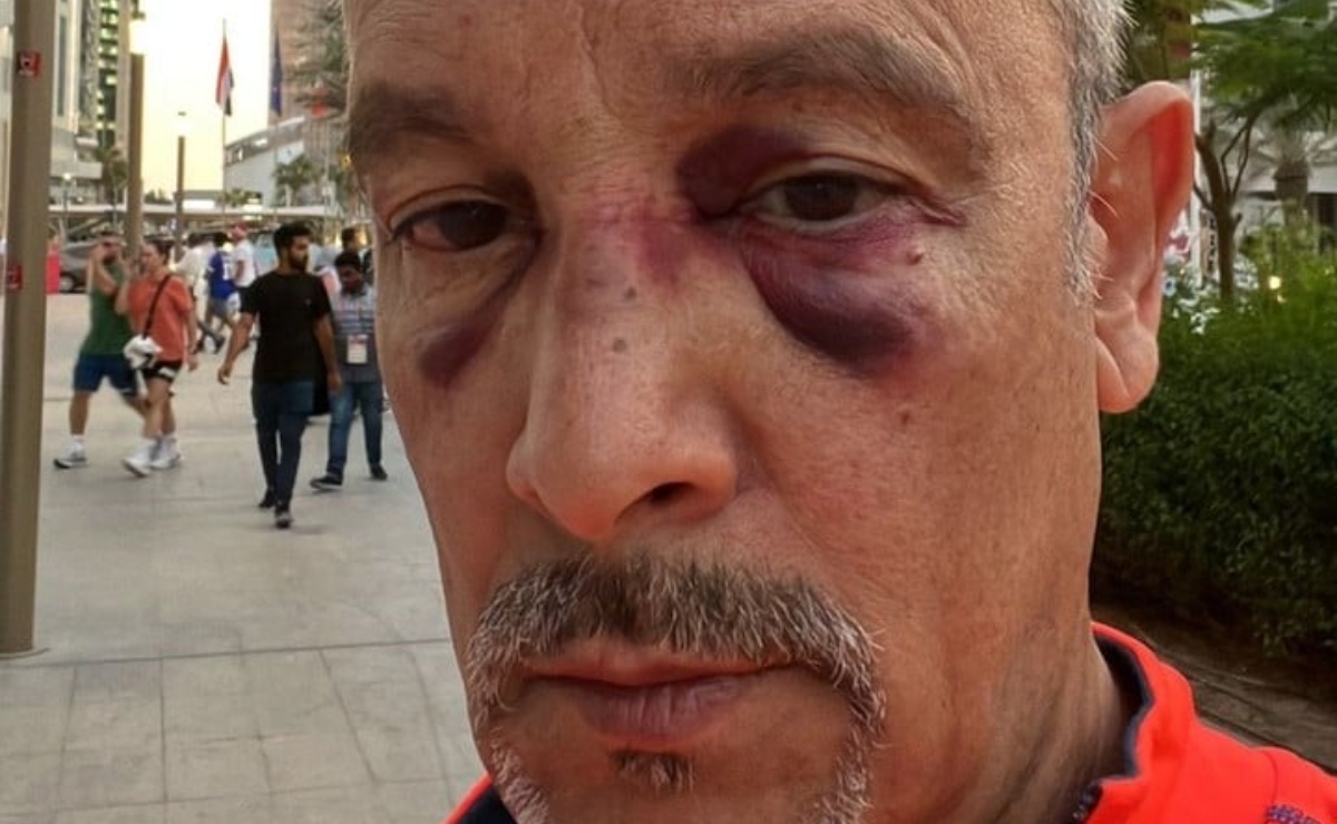 El ataque a Luis Aguirre fue registrado en video. | Foto publicada en Clarín