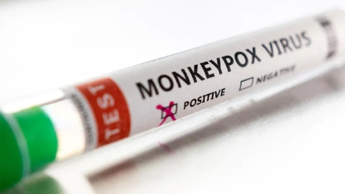 Viruela del mono será llamada ahora 'mpox'; informó la OMS