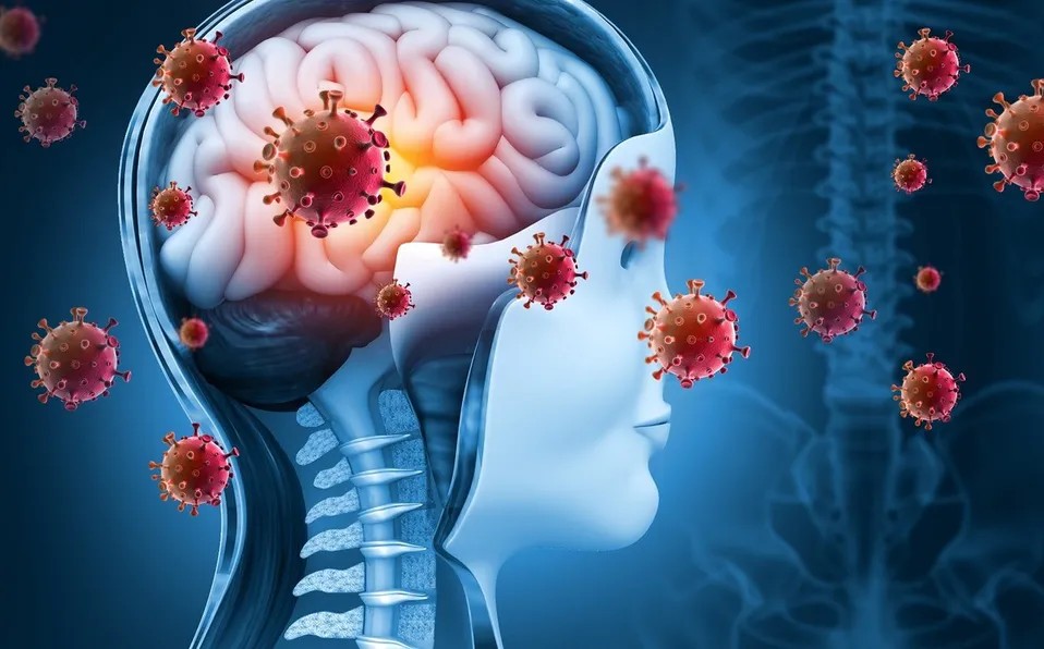 En Durango, meningitis aséptica registra más de 70 casos y 22 defunciones