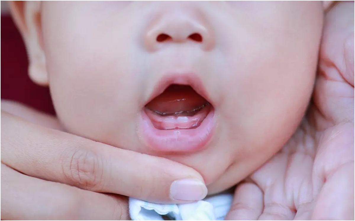 El origen principal de las caries es la falta de higiene. | Especial