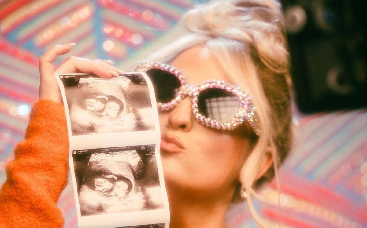 Meghan Trainor (Instagram).