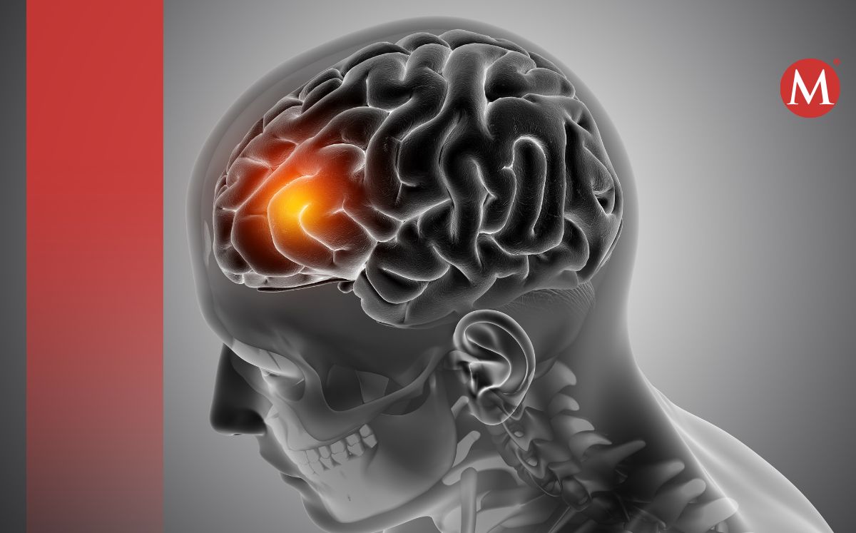Meningitis cobra otra vida en Durango; suman 34 víctimas. (Especial)