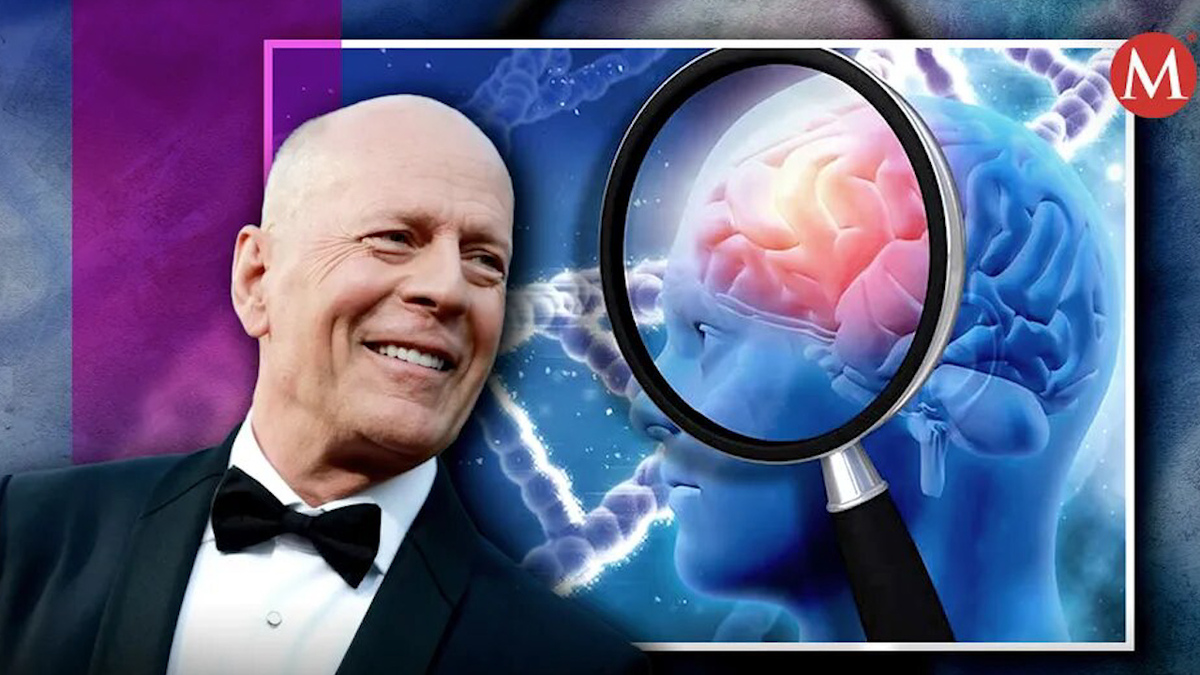 Bruce Willis es diagnosticado con demencia frontotemporal