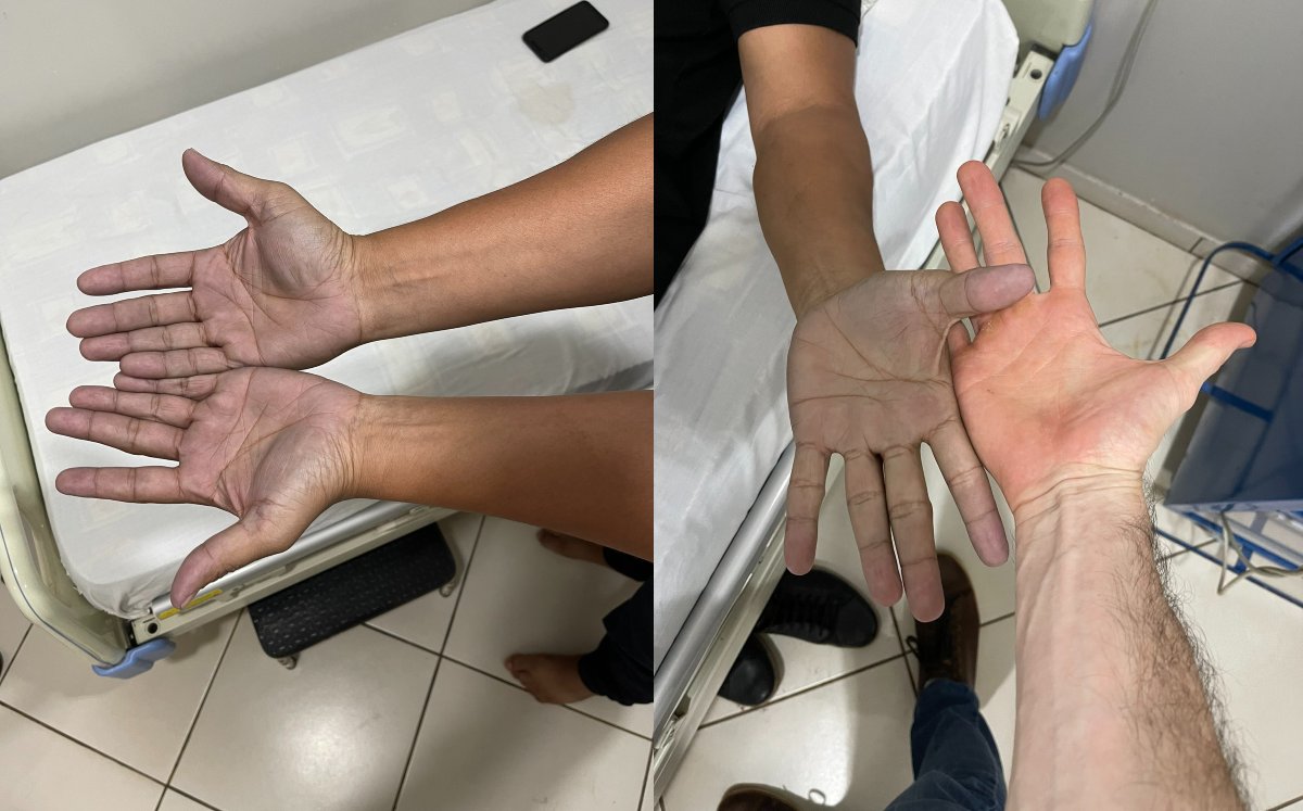 Joven acude al médico por extraño color azul en sus manos | Twitter