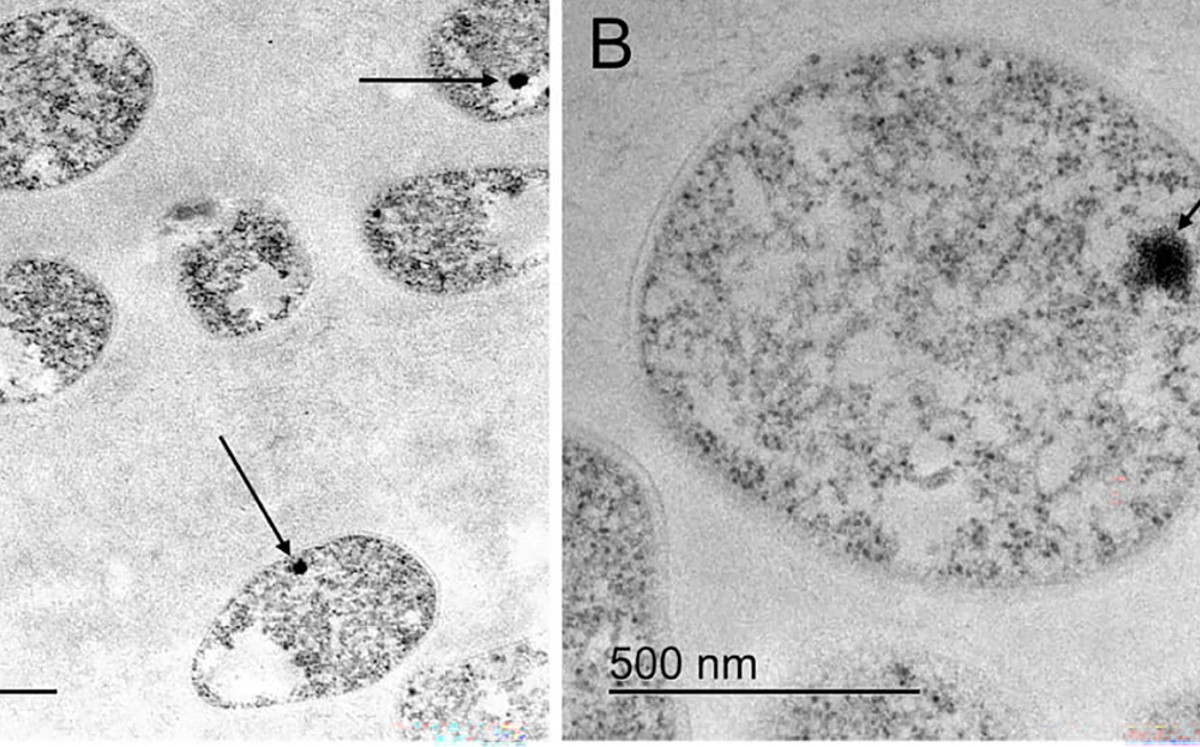 El descubrimiento fue posible gracias al uso de técnicas clásicas de microscopía y análisis de genómica y proteómica. | UNAM