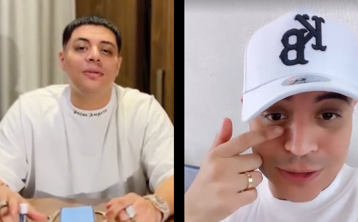 Eduin Caz aparece con moretones en los ojos | ESPECIAL