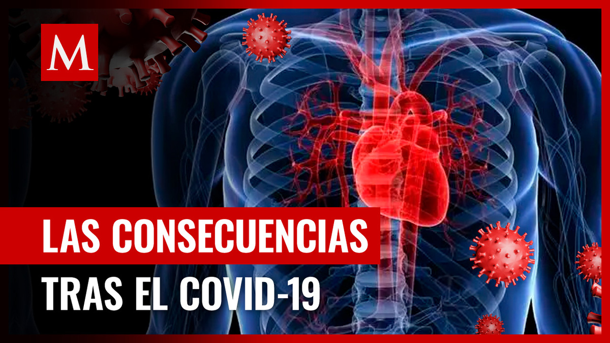 Pacientes que tuvieron covid hace dos años presentan problemas de pulmón y corazón
