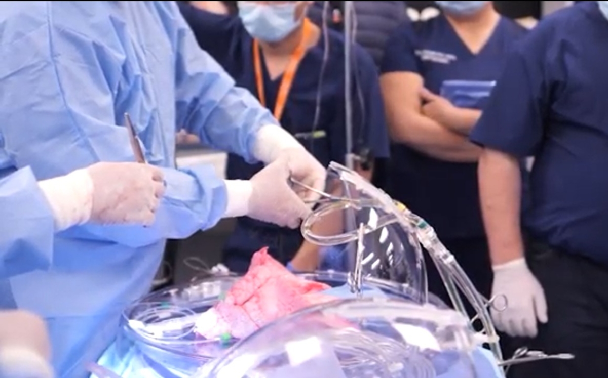 EVLP, nueva esperanza de vida para los pacientes que requieren un trasplante de pulmón | Especial