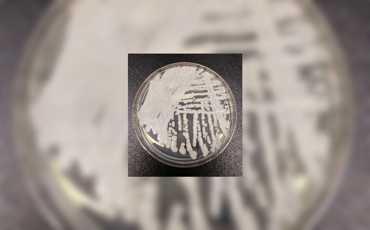 Foto del hongo Candida Auris compartida pr CDC de Estados Unidos. (AFP)