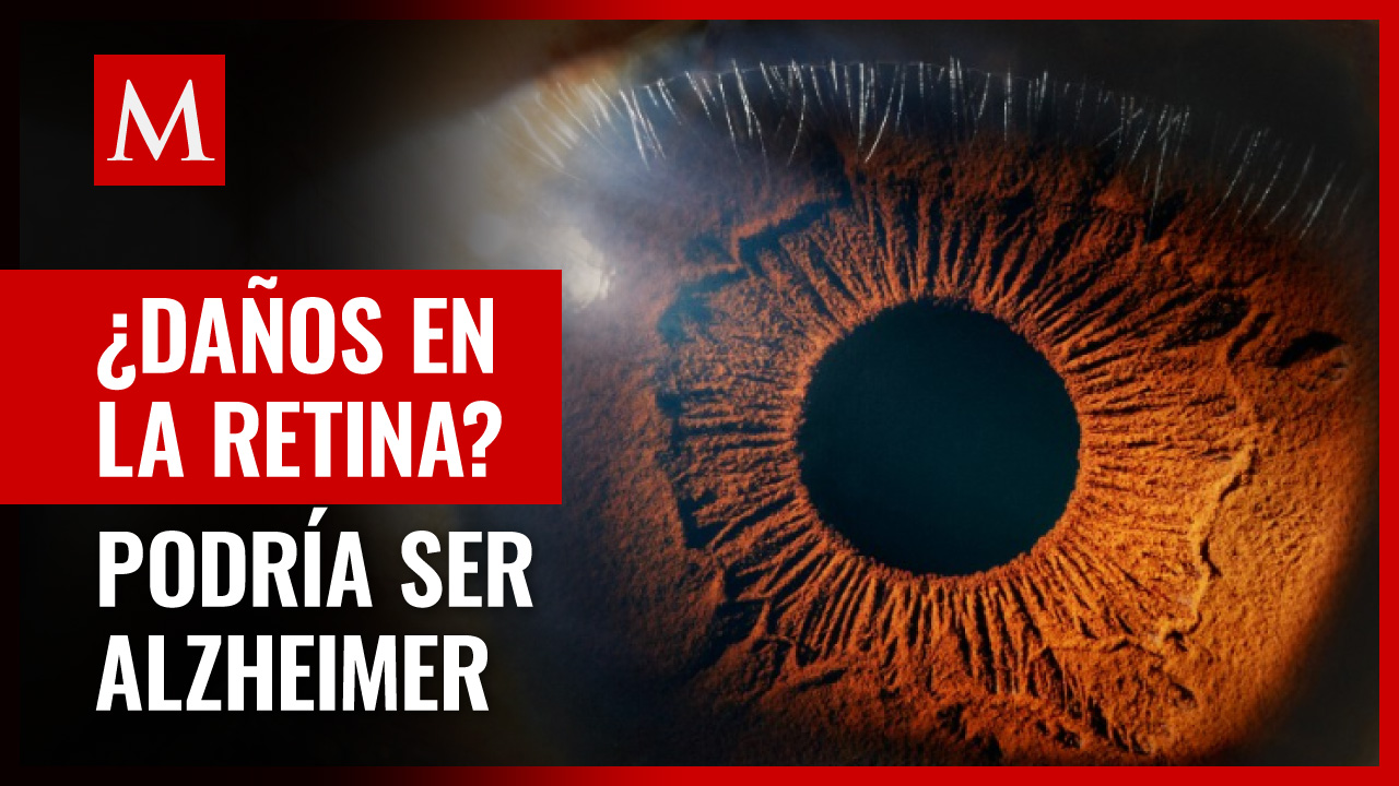 Alzheimer podría ser detectado por daños en la retina, según estudio