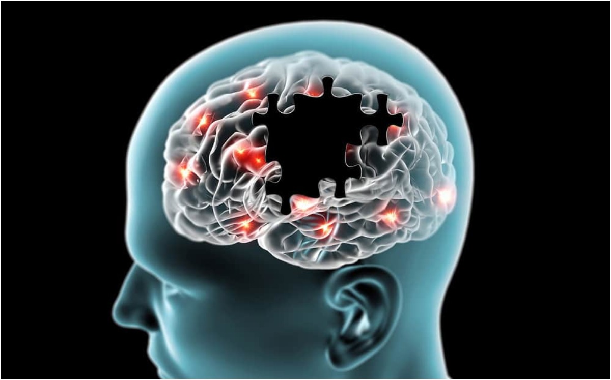 Zonas del cerebro dañadas por la hipertensión afectan el desarrollo de demencia | Especial
