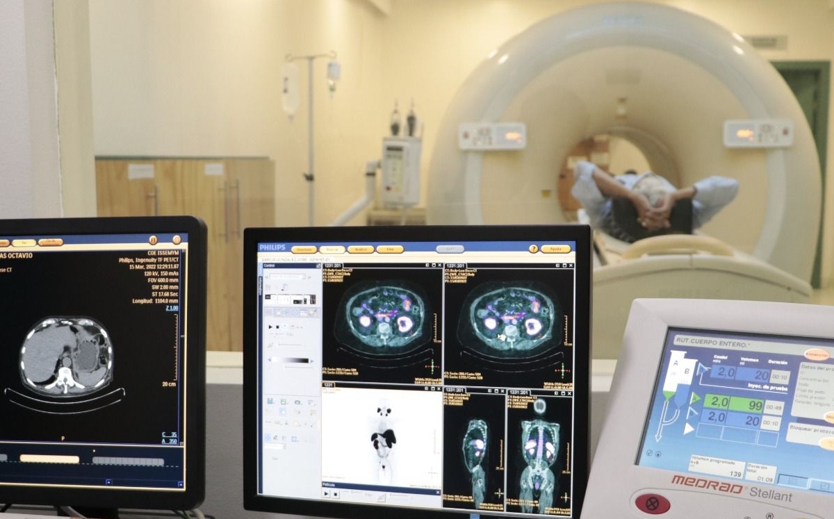 Personas con obesidad son más propensas de padecer cáncer de colon. Especial