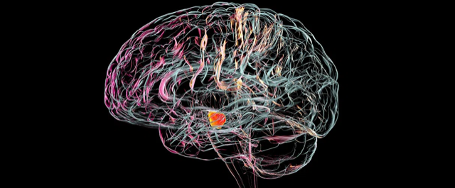 Estudian células que podrían detener la progresión de la enfermedad de Parkinson (Shutterstock).