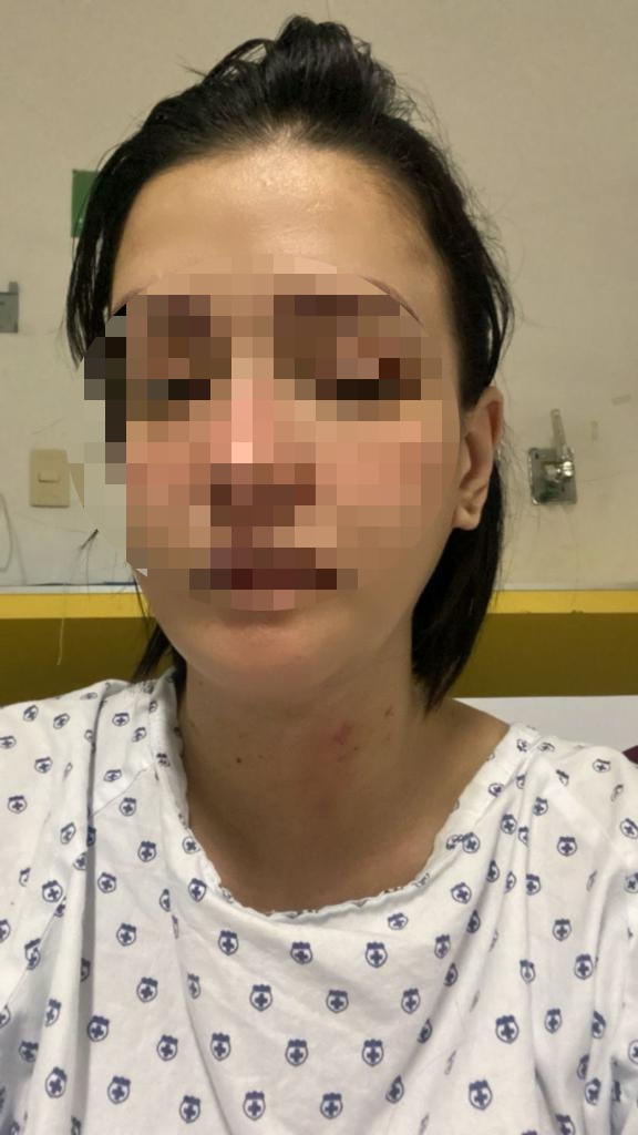 Mujer víctima de intento de feminicidio. (Especial)