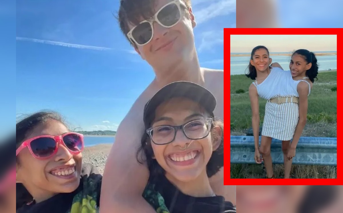 Hermanas siamesas se hacen virales por su historia (Especial).