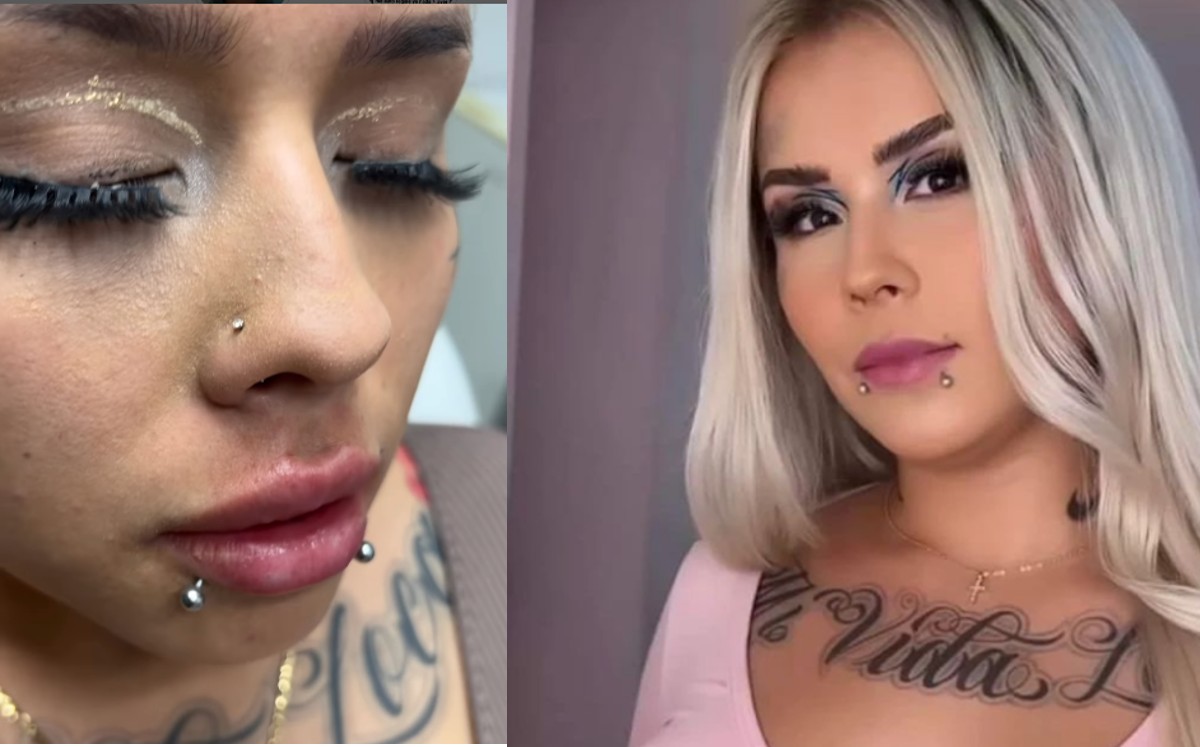Mona aumenta sus labios y la critican en redes sociales