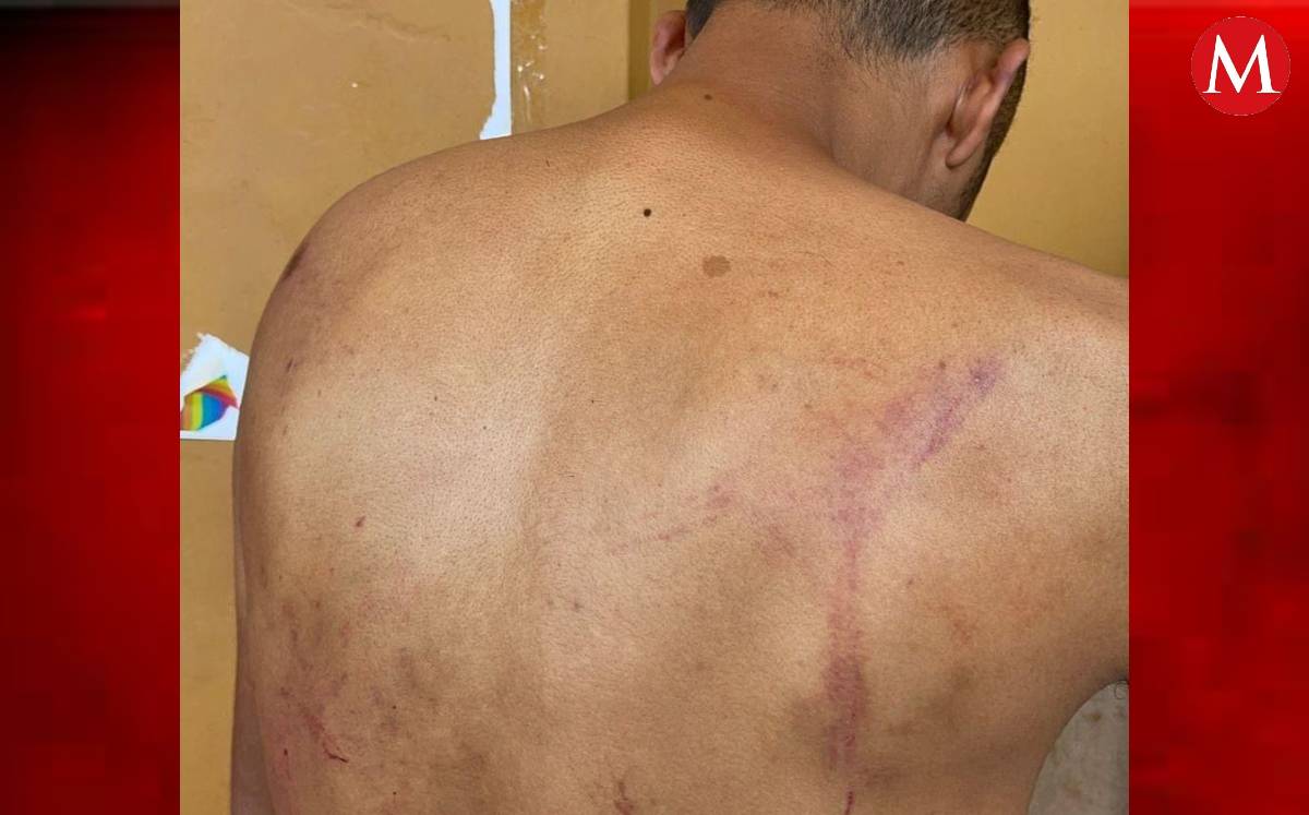 Agresión a reportero en Celaya