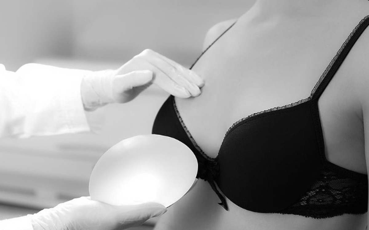 Mamoplastia. / Instagram