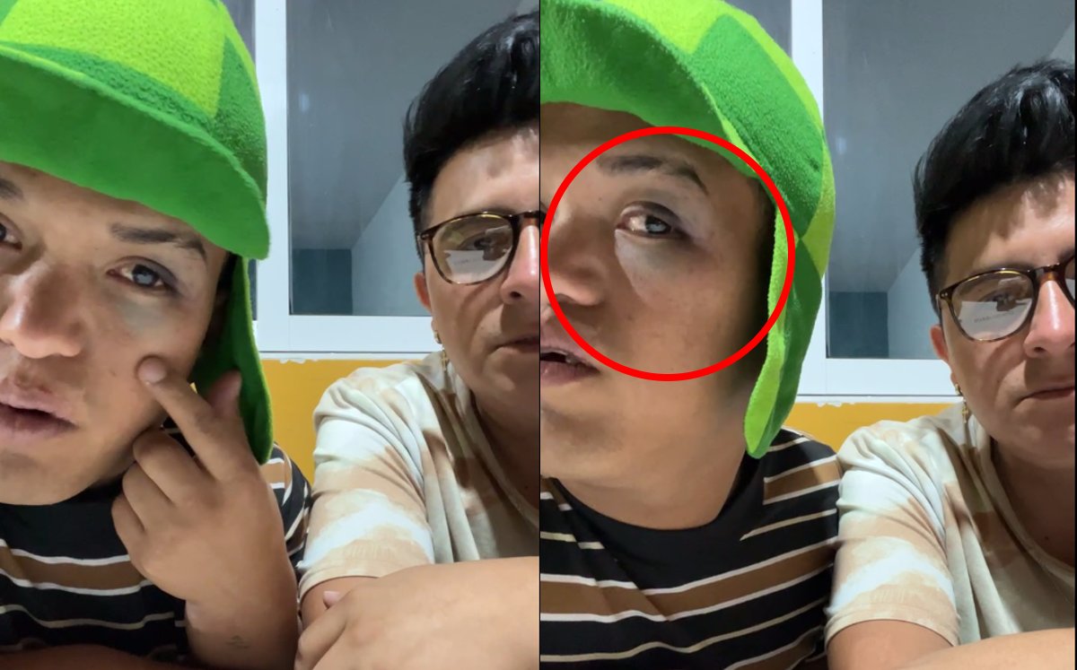 Medio Metro es golpeado por supuesto fan de Sonido Pirata | Especial