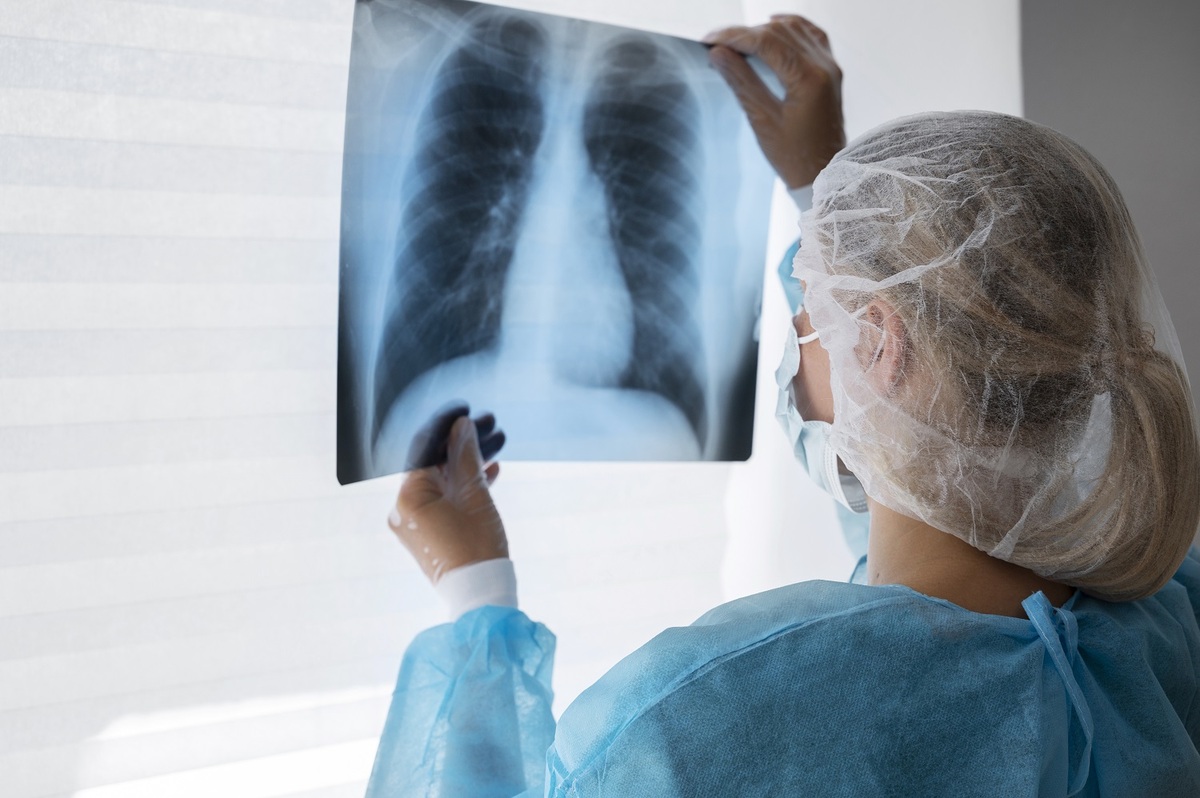 Los casos de tuberculosis han aumentado en Tabasco durante 2023. | Freepik