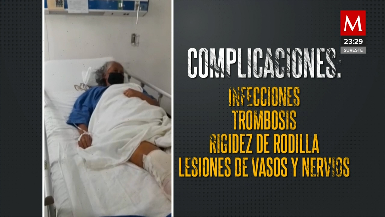 Médicos operan pierna equivocada a mujer de 67 años en el ISSSTE